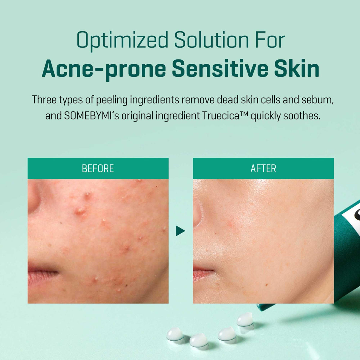 SOME BY MI hypoallergenic testing label close-up signaling skin-friendly testing.