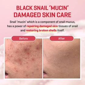 SOME BY MI Snail Trucica Serum being gently applied to the face.