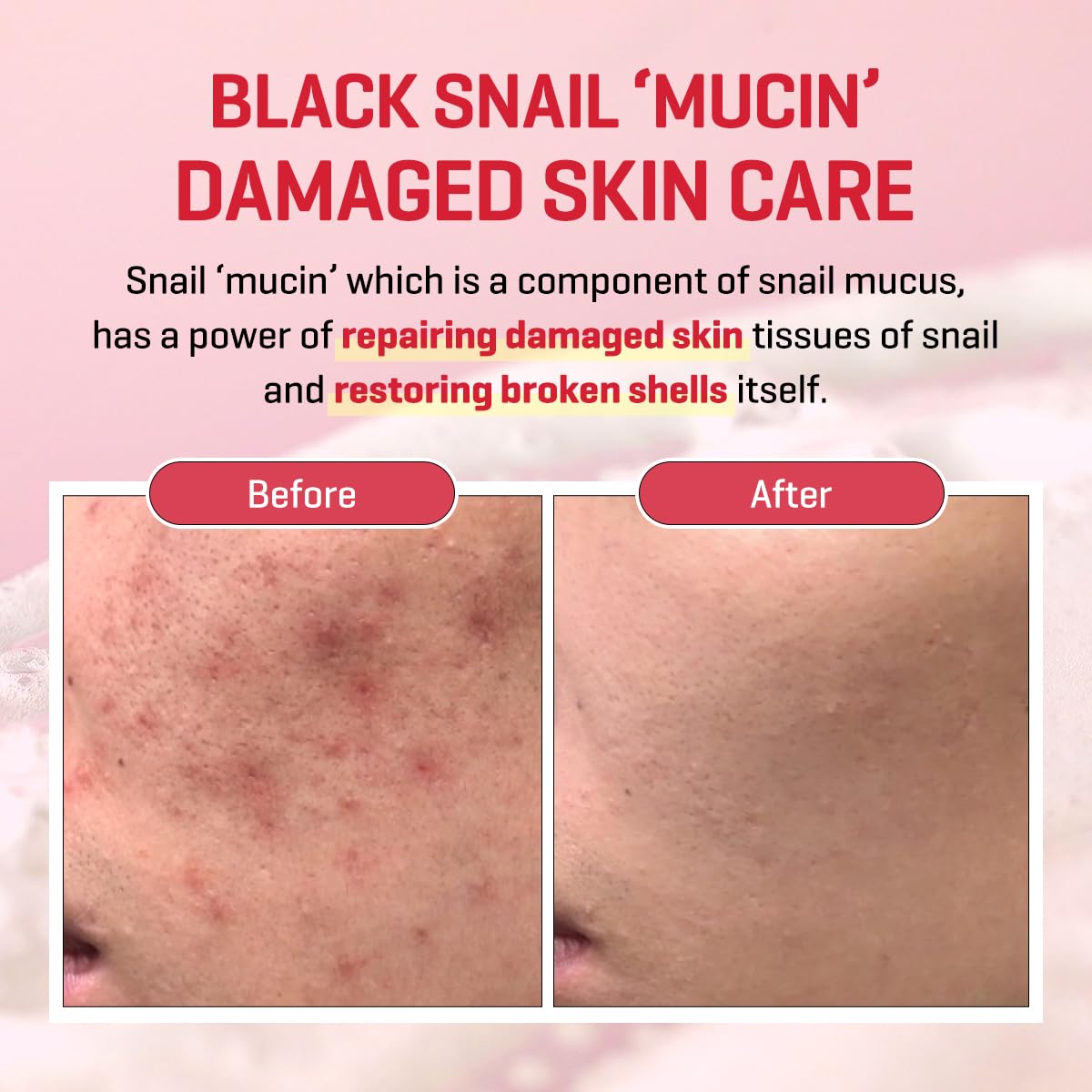 Cream applied on hand demonstrates daily moisturizing and barrier support