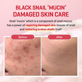 Cream applied on hand demonstrates daily moisturizing and barrier support