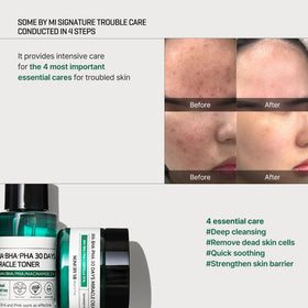 SOME BY MI Tea Tree Water close-up emphasizing soothing properties for trouble-prone skin.