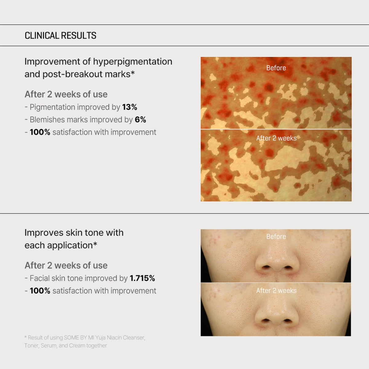 Some By Mi Yuja Niacin Anti Blemish Cream night masking for moisture