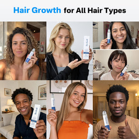 Full hair density concept with before-after visuals