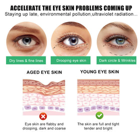 SORYA caffeine eye cream for day and night use.