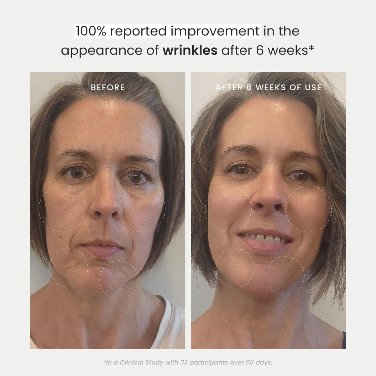Barrier hydration focus image for The Spa Dr. Antioxidant Serum indicates moisture support.