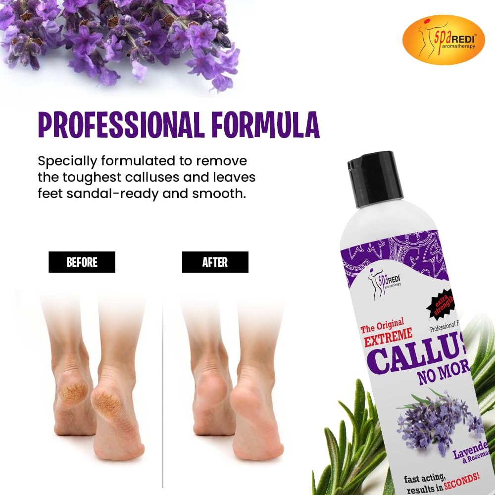 SPA REDI Callus Remover smooths feet for sandal season readiness