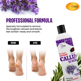 SPA REDI Callus Remover smooths feet for sandal season readiness