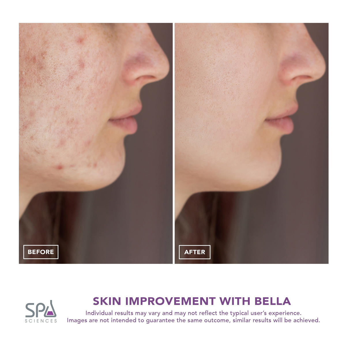 Spa Sciences Bella compact cordless device ideal for on-the-go care.
