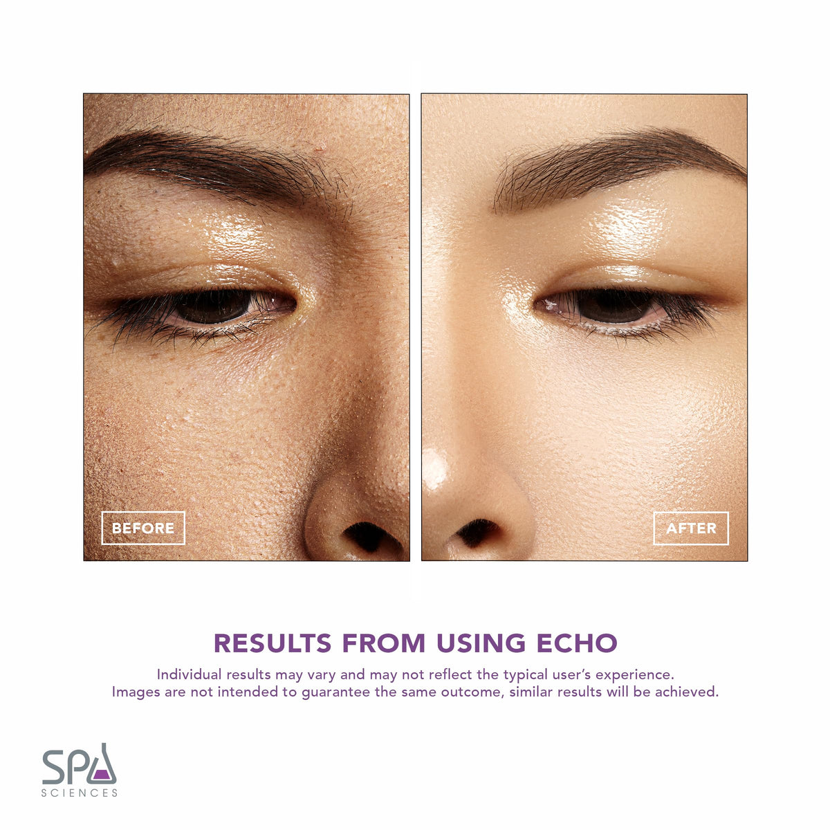 Spa Sciences ECHO ergonomic grip for comfortable extended use.