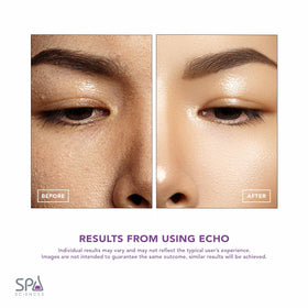 Spa Sciences ECHO ergonomic grip for comfortable extended use.