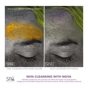 Spa Sciences Nova soft bristles delivering gentle exfoliation for sensitive skin.