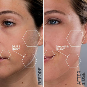 Spa Sciences SIMA Dermaplane Tool showing three speeds for personalized exfoliation.