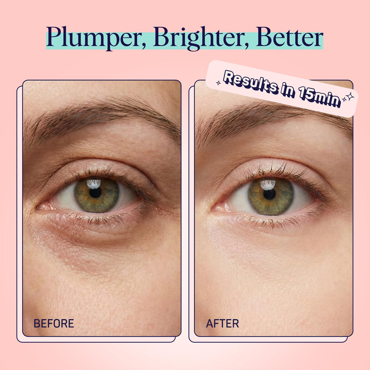 SpaLife eye pads with watermelon extract for brightening and moisturized skin