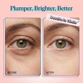SpaLife eye pads with watermelon extract for brightening and moisturized skin