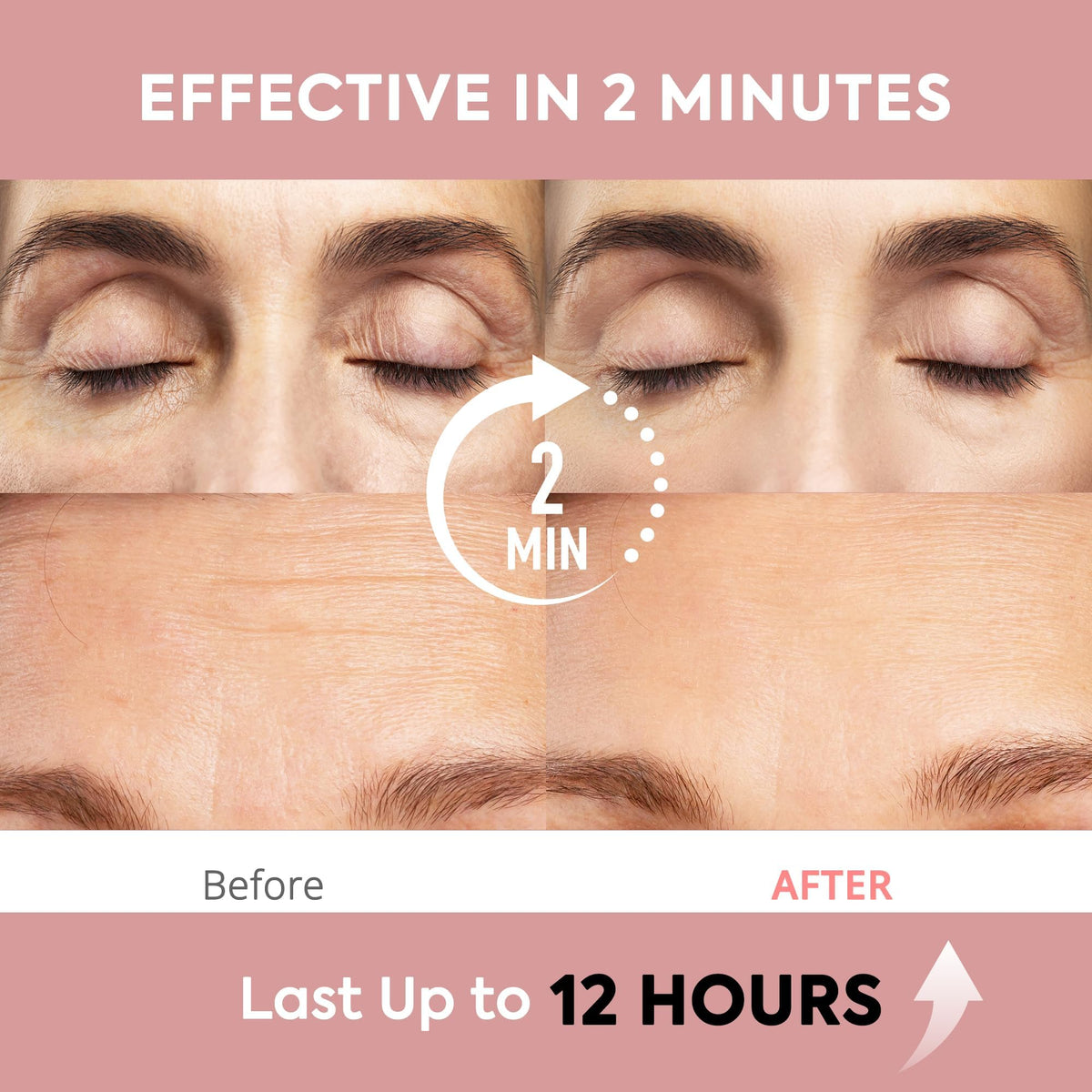 St. Mege application around eyes to reduce puffiness and lines.