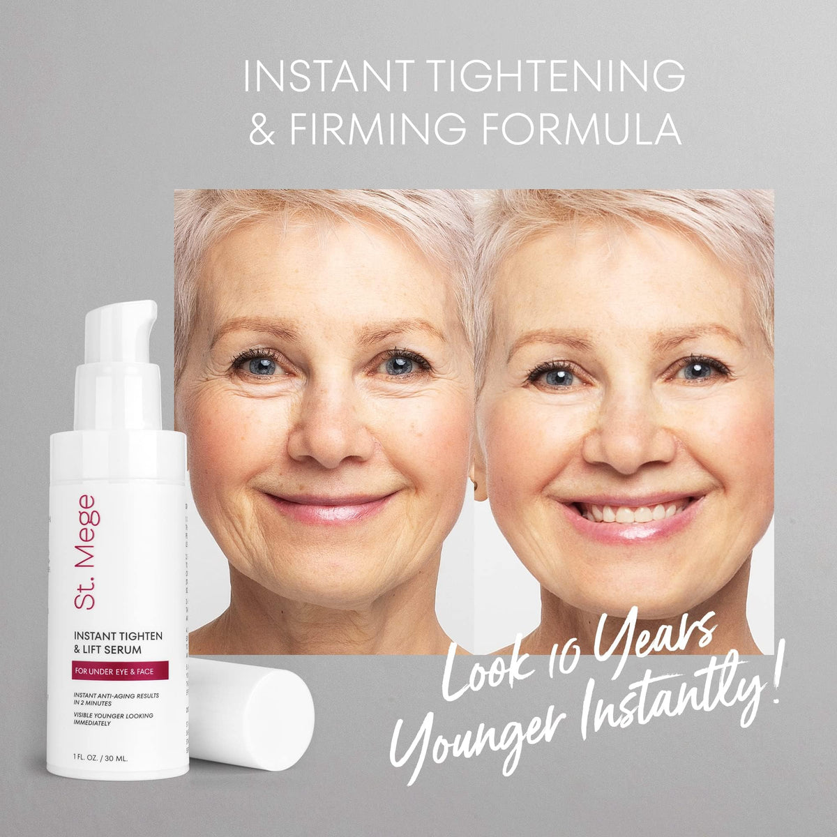 Wrinkle-erasing effect on smile lines after application