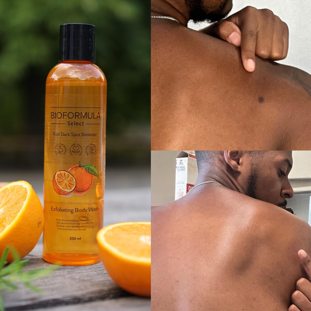 Stop Guessing BioFormula Select after-shower glow suggests more even tone.