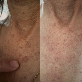 Stop Guessing BioFormula Select applying on elbows and knees during routine.