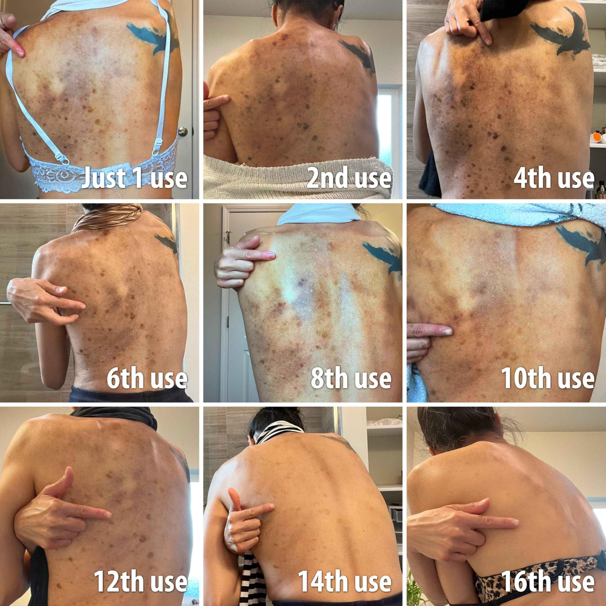 Stop Guessing BioFormula Select pump demonstrates multi-area use for discoloration.