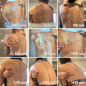 Stop Guessing BioFormula Select pump demonstrates multi-area use for discoloration.