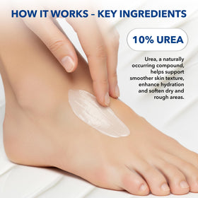 STRATUS PHARMACEUTICALS Urea 10% Lotion applied on feet to soften rough skin