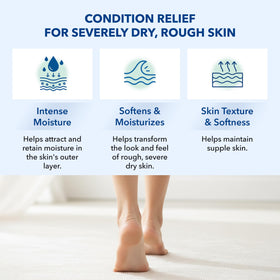 STRATUS PHARMACEUTICALS Urea 10% Lotion used on elbows and knees for smoother texture