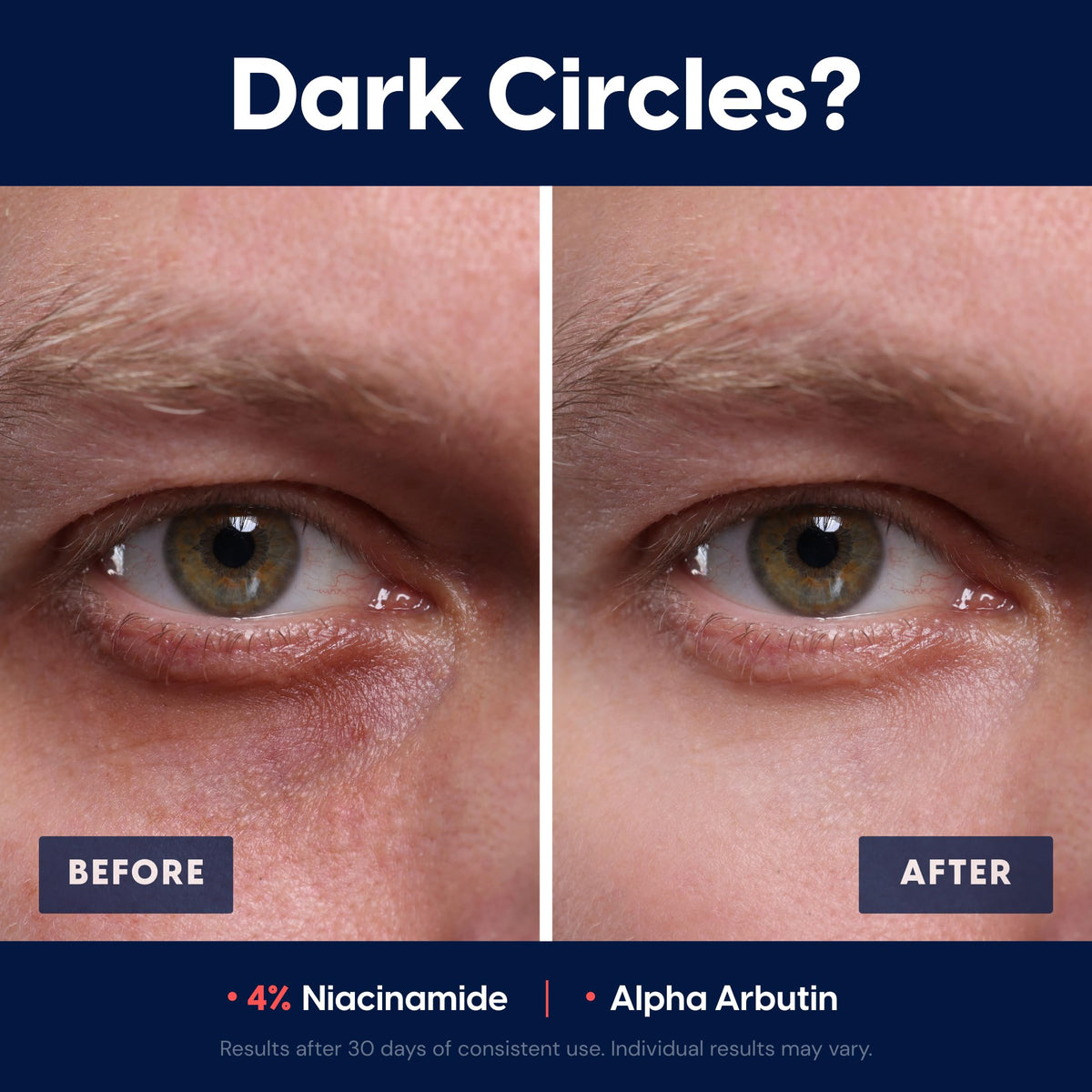 Strive men face moisturizer pump in use demonstrates fast absorption and non-greasy finish.