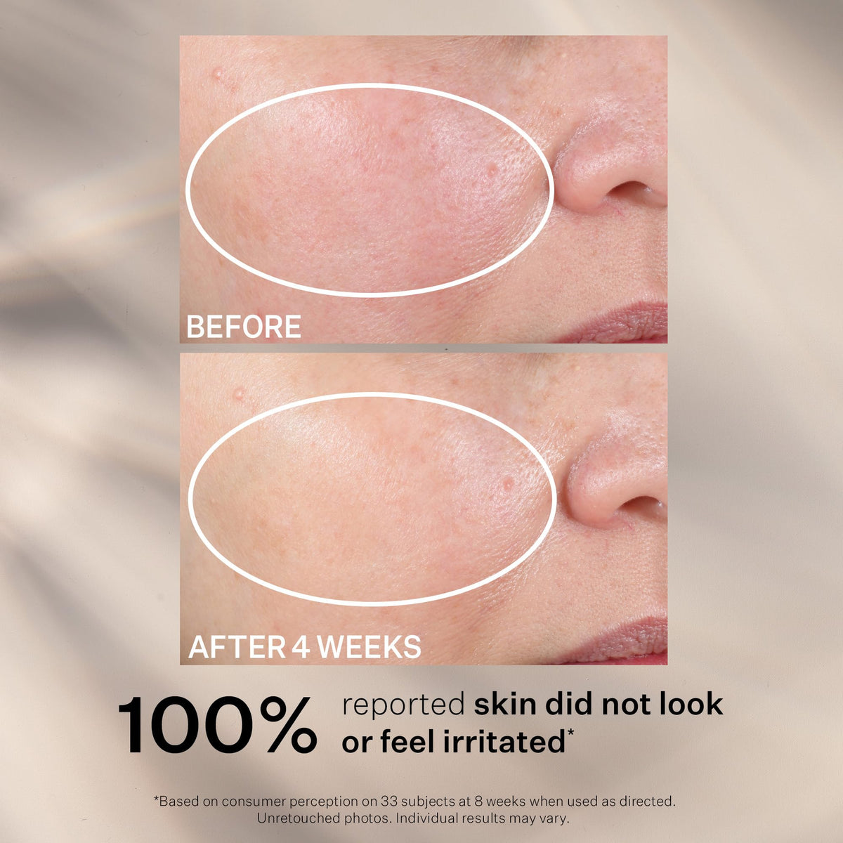Gentle barrier-supporting formula image for StriVectin Advanced Night Moisturizer