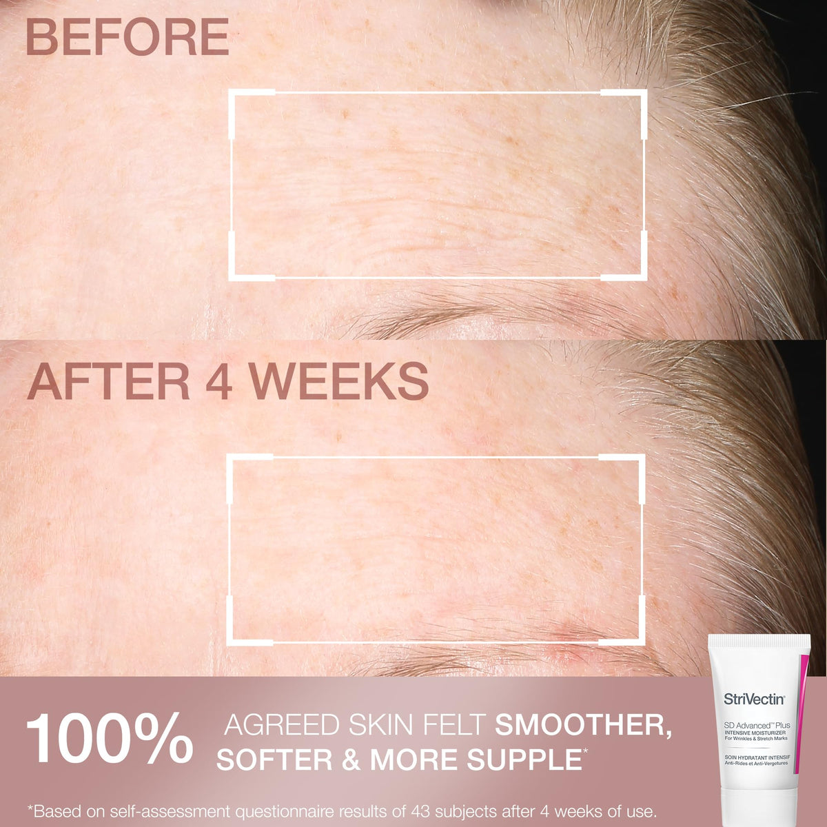 StriVectin Copper Tripeptide Cranberry Biopeptides, ingredients designed to support skin texture.