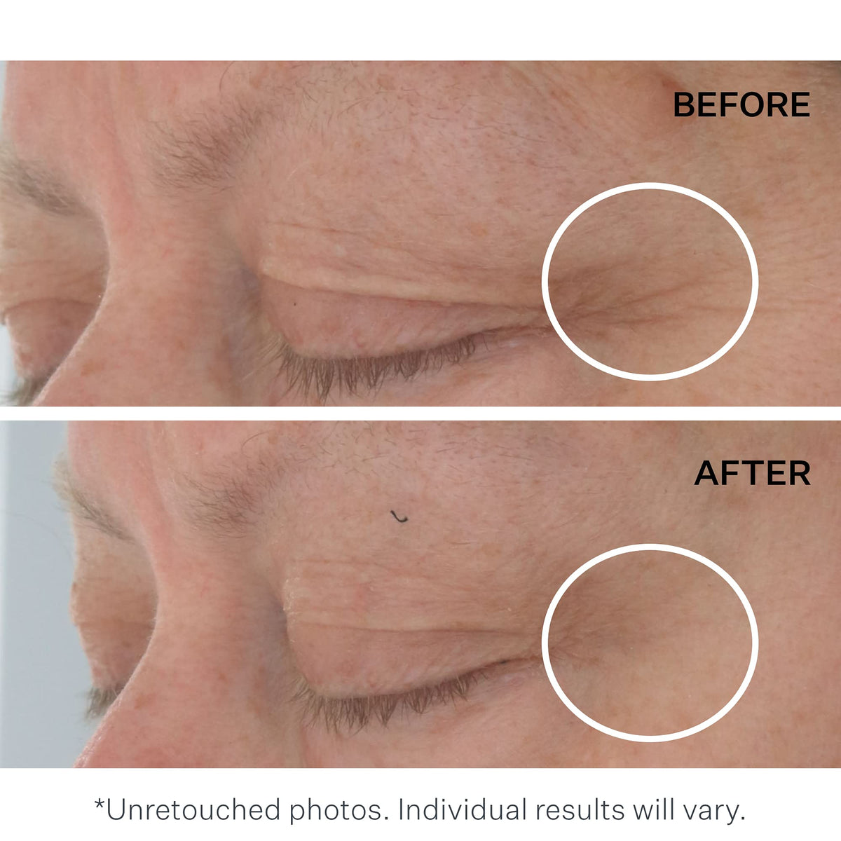 StriVectin dual-phase eye gel-cream shows gel and cream layers.
