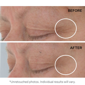 StriVectin dual-phase eye gel-cream shows gel and cream layers.