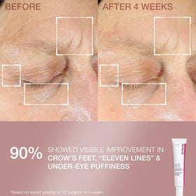 StriVectin Eye Concentrate application, gentle under-eye care for daily use.