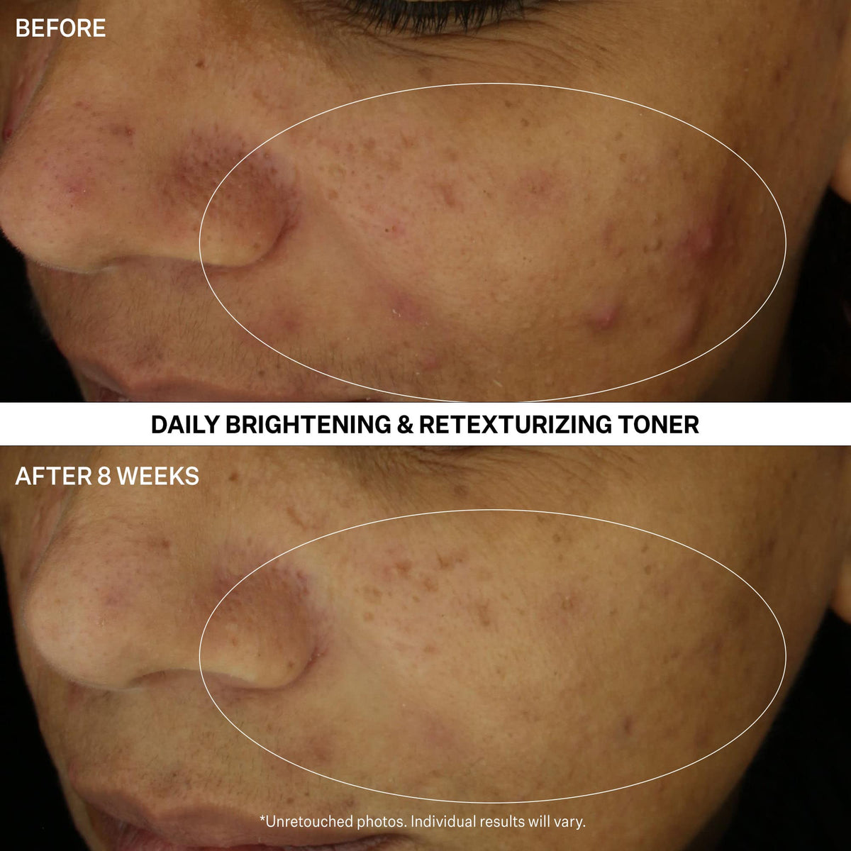 StriVectin Multi Action Clear toner dispense pump enables easy application.