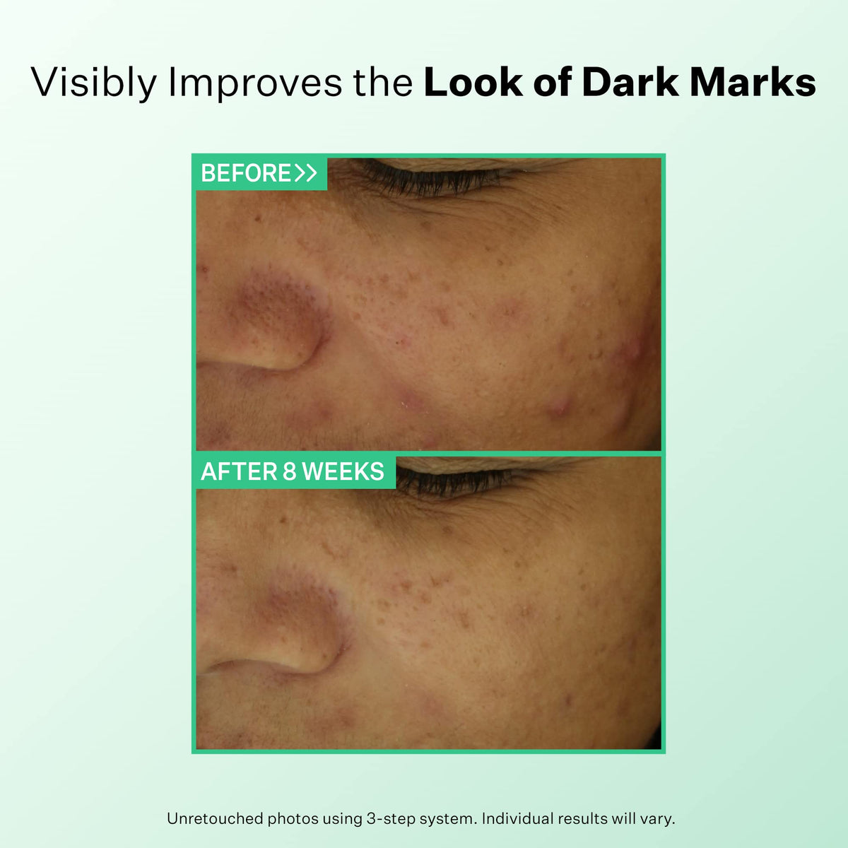 StriVectin Multi Action Clear toner on-face application demonstrates gentle toning.