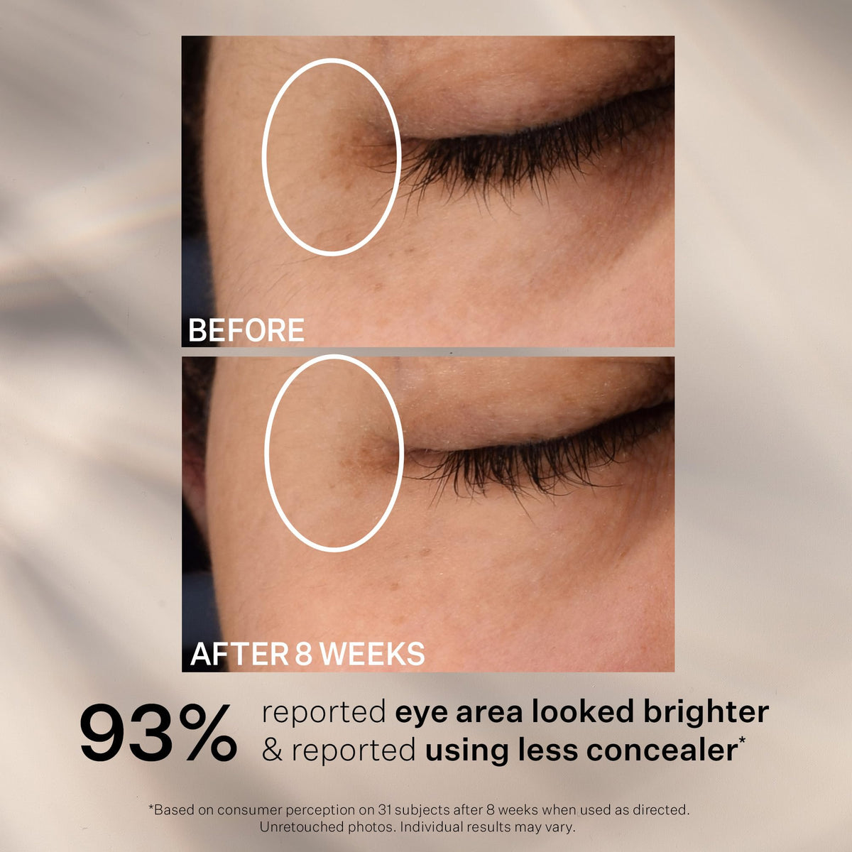StriVectin Super C Dark Circle Eye Serum glow on skin shows radiant under-eye area