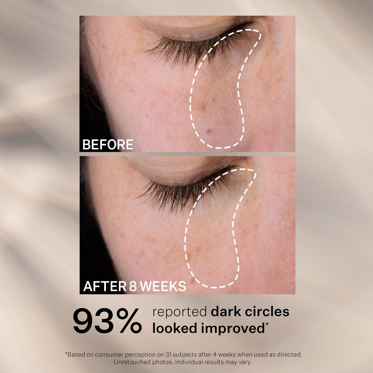 StriVectin Super C Dark Circle Eye Serum ingredients label emphasizes Vitamin C and botanicals