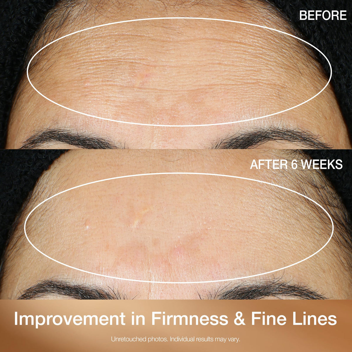 Droplet dispensed onto skin to promote even tone and smooth texture.