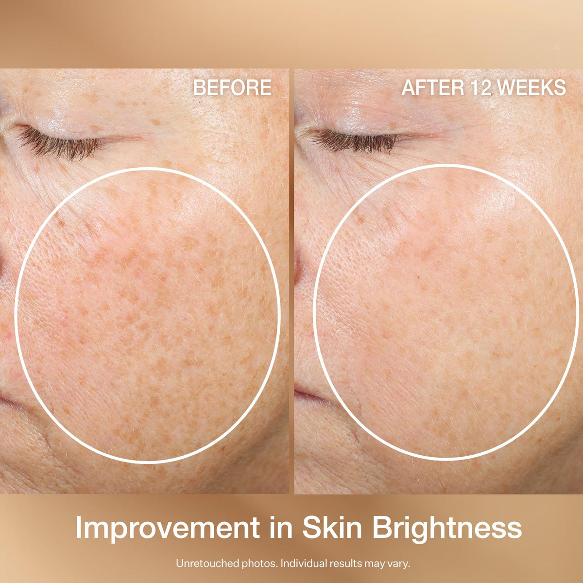 Hand applying StriVectin serum showing fast-absorbing finish.