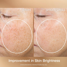 Hand applying StriVectin serum showing fast-absorbing finish.