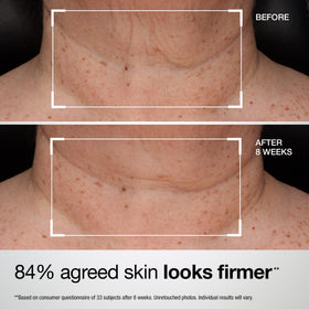 Applying StriVectin TL Advanced Neck & Chest Lotion SPF 35 correctly.