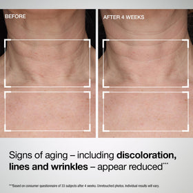 Product packaging featuring StriVectin TL Advanced label and SPF 35.