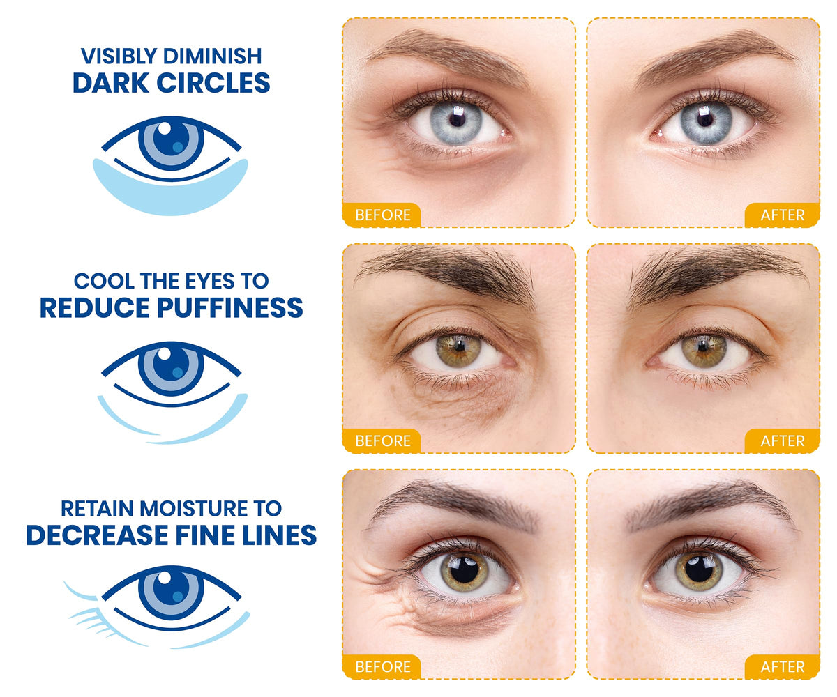 Stylia under-eye patches applied on skin for a cooling, depuffing feel