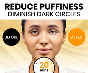 Stylia patches with vitamin C and hyaluronic acid hydrate the eye contour.