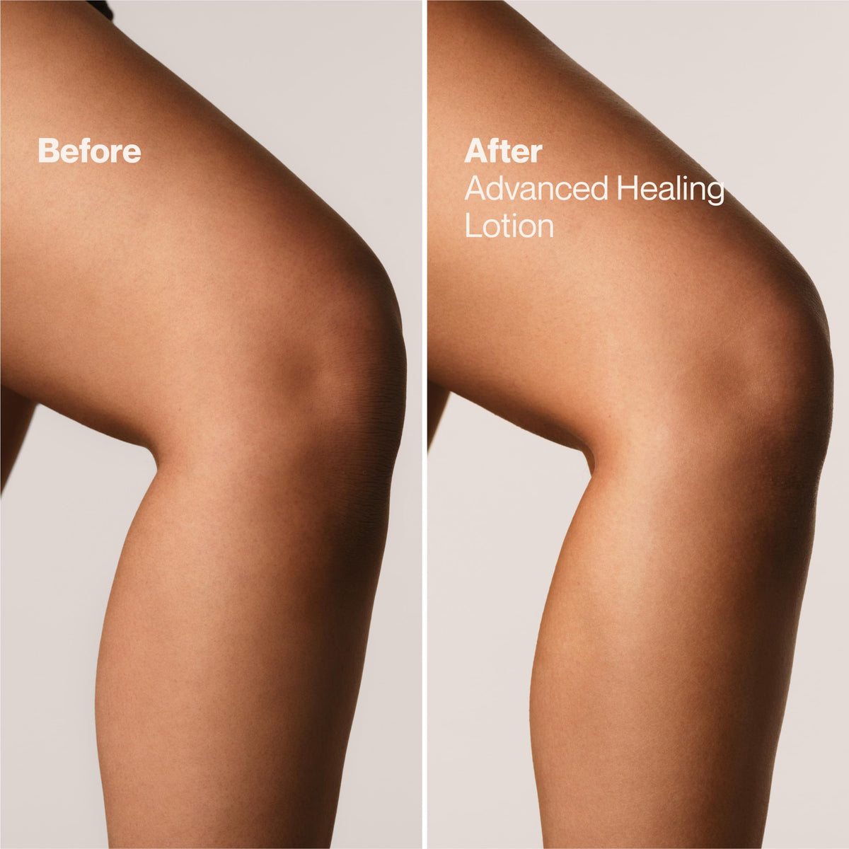 Dermatologist-tested badge on packaging signals allergen-free formula.