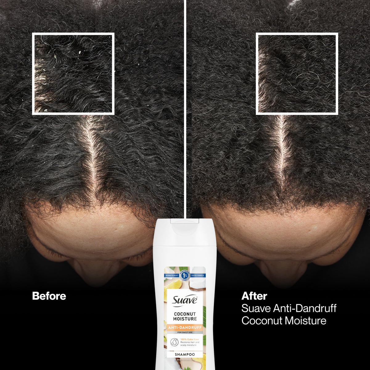Dermatologist-tested label on Suave shampoo bottle