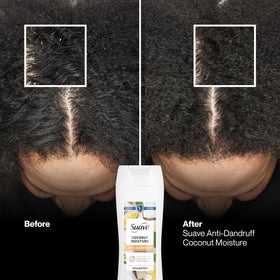 Dermatologist-tested label on Suave shampoo bottle