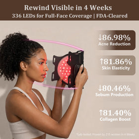 SUBRUN device shows four wavelengths enabling versatile skincare sessions.