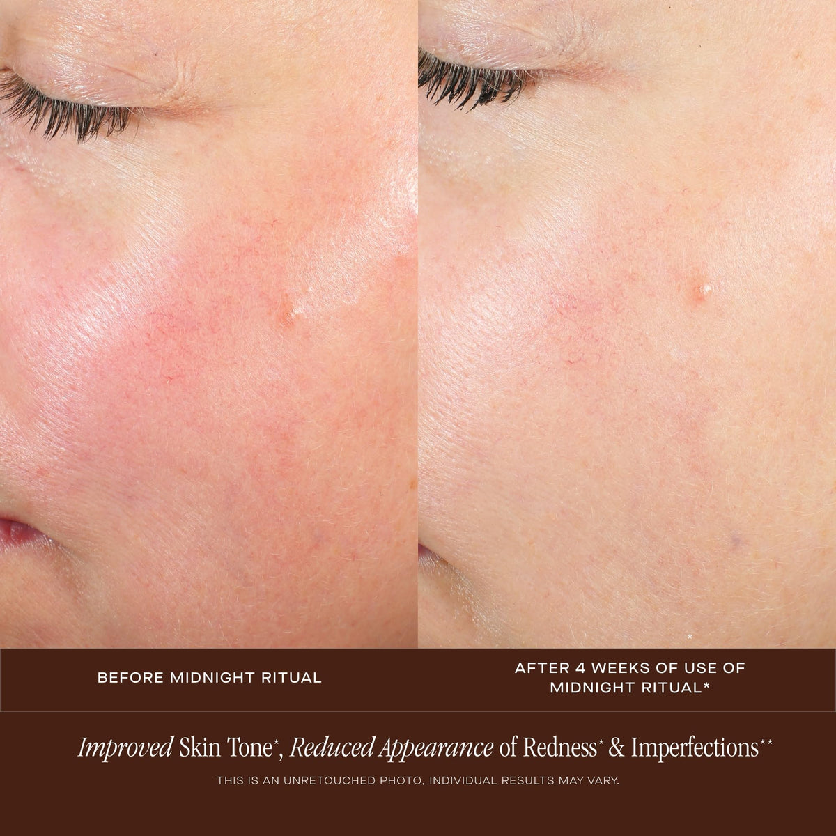 Summer Fridays Midnight Ritual Serum packaging box highlights premium experience.