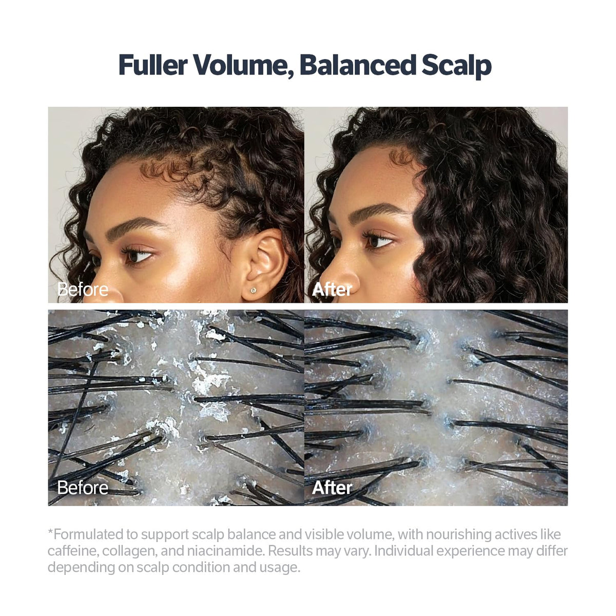 SUNGBOON EDITOR pore-tightening appearance illustration for refined scalp look.