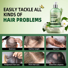 Sunspeak rosemary conditioner bottle with mint and tea tree visuals suggests scalp-refreshing aroma.